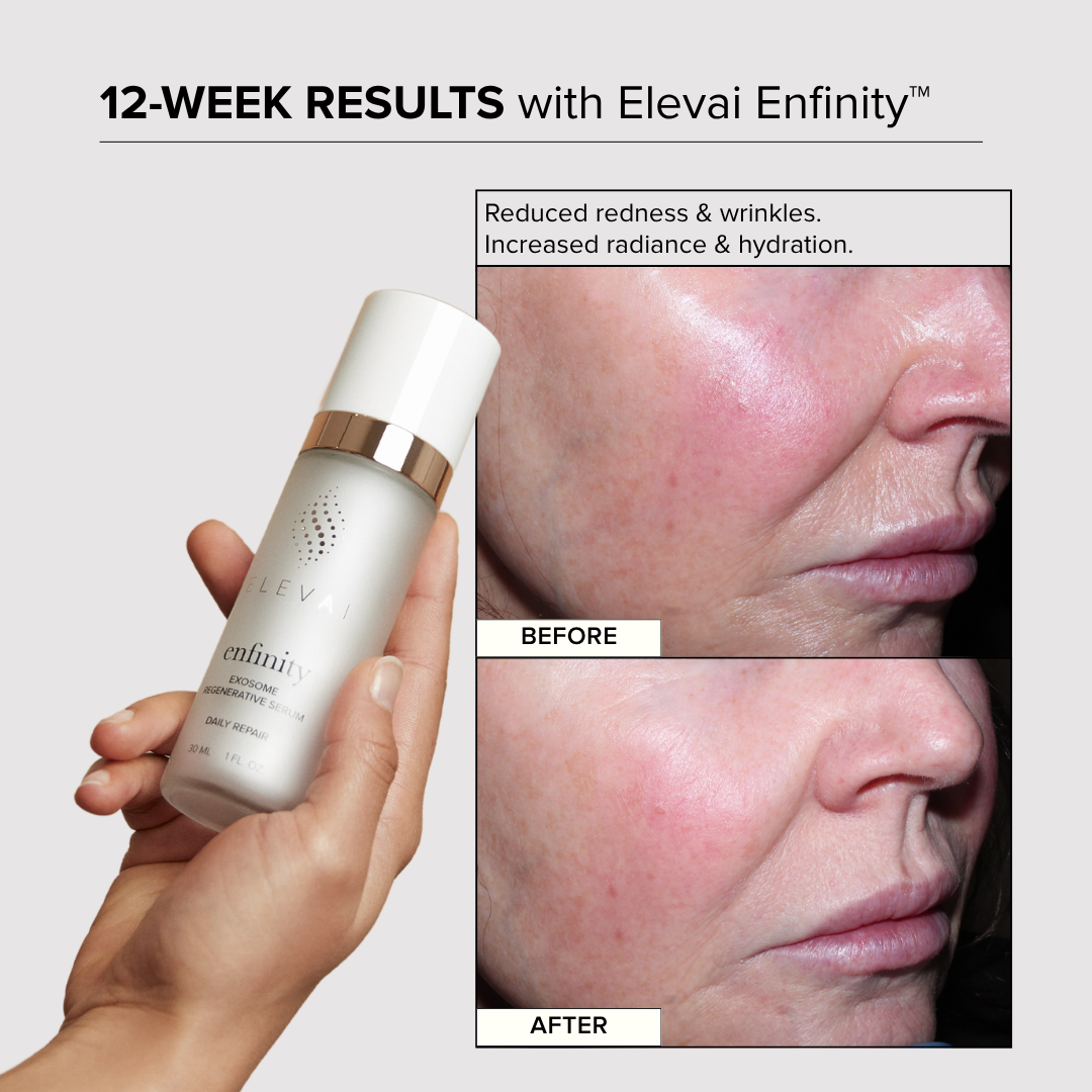 The Elevai Skin Renewal Trio