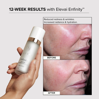 The Elevai Skin Renewal Trio